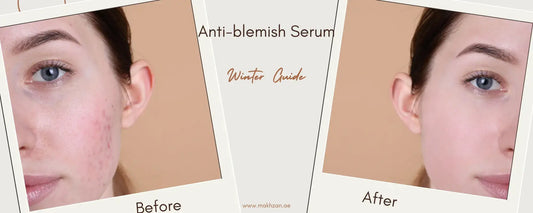 Before and after results of using Anti blemish Serum in a winter skincare routine.