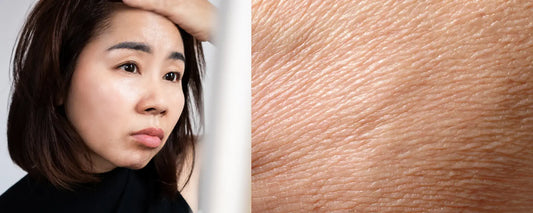 Image depicting dehydrated skin in Dubai, showing a concerned woman and close-up skin texture.
