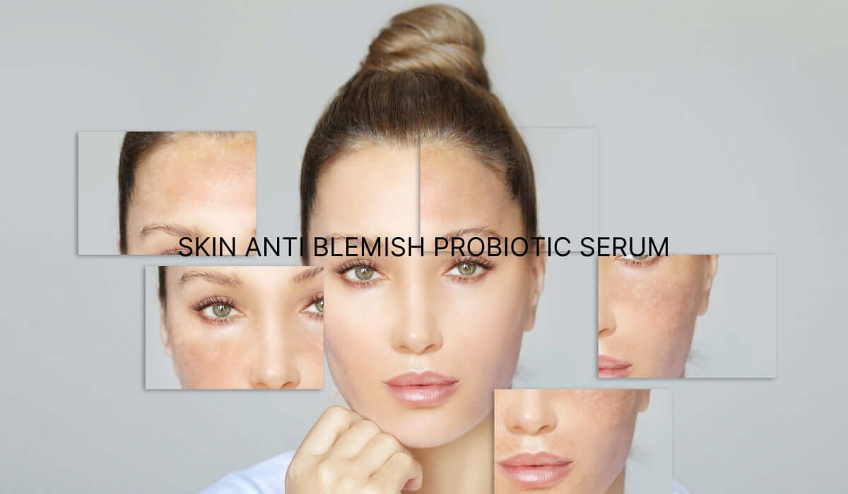 Skin ant blemish probiotic serum